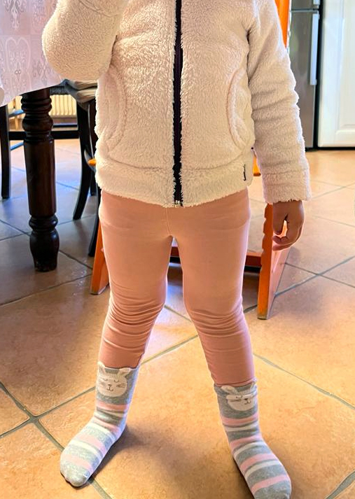 gambe storte bambini